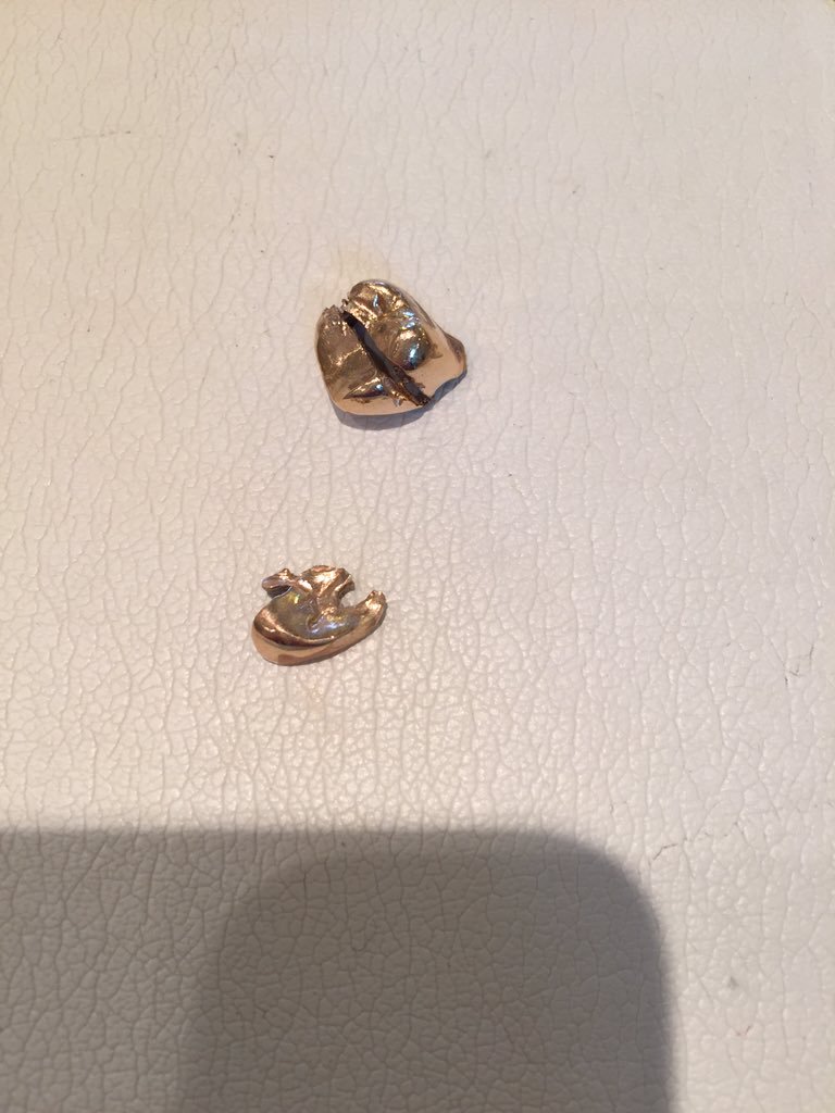 【買取速報】金歯のお買取ですね。
